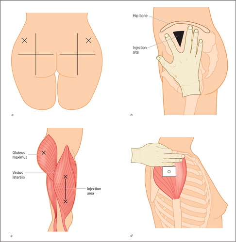 intramuscular-injection-testosterone